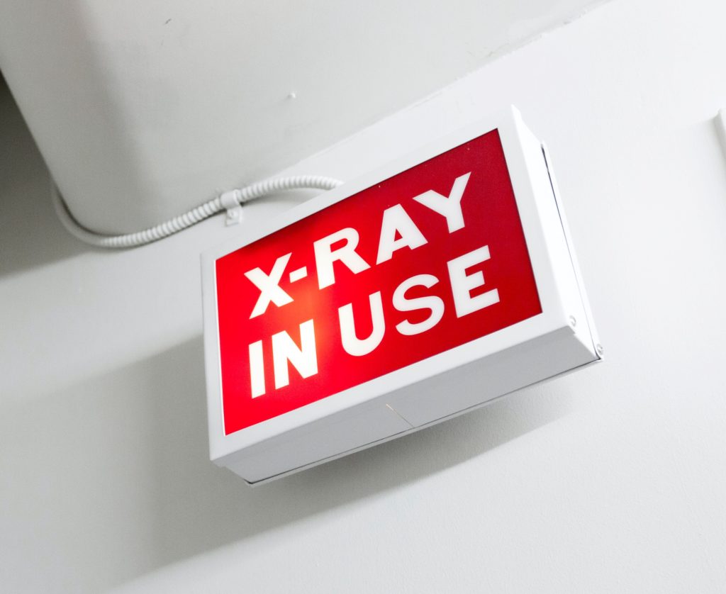 Dental x-rays- What are they for and are they safe?